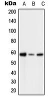 PFKFB2 Antibody (phospho-Ser483)