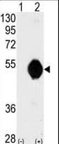 DOK2 Antibody (aa380-412)