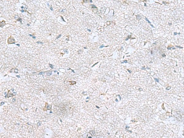 Polyclonal Rabbit anti-Human GFRA1 / GFR Alpha Antibody (IHC, WB)