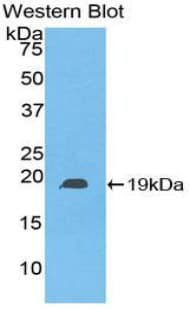 HSPB6 / HSP20 Antibody (aa1-162)