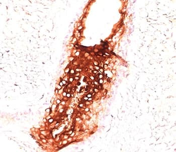 KRT17 / CK17 / Cytokeratin 17 Antibody (clone E3, Azide-free, BSA-free)