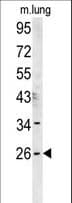 Polyclonal Rabbit anti-Human DNAJC8 Antibody (aa210-239, WB)