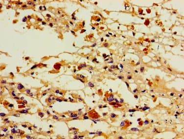 Polyclonal Rabbit anti-Human PGIS / PTGIS Antibody (IHC)