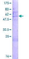 Human SNRPA1 Protein (Recombinant GST)