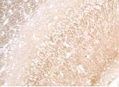 Polyclonal Rabbit anti-Human MAP1LC3A / LC3A Antibody (aa89-120, IHC, IF, WB)