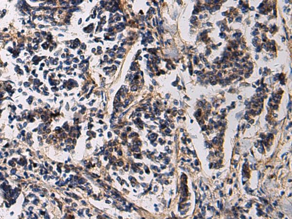 SSH3 Antibody