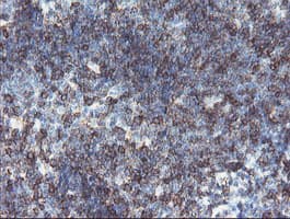 Monoclonal Mouse anti-Human DPH2 Antibody (clone OTI4D9, IHC, WB)