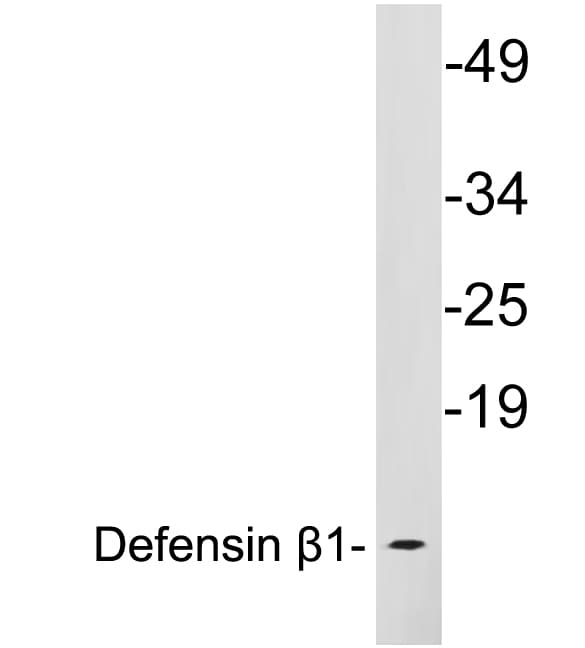 DEFB1 / BD-1 Antibody (aa28-77)