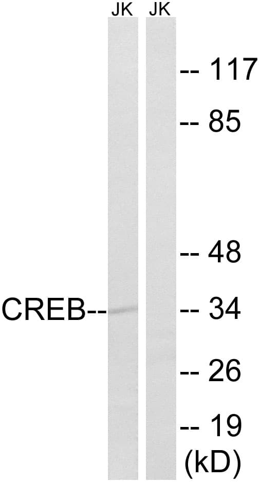 Polyclonal Rabbit anti-Human CREB1 / CREB Antibody (aa71-120, WB)
