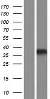 HOXB1 Protein (Over-Expression Lysate Myc-DDK (Flag))