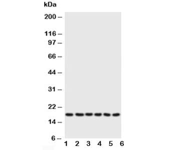 Polyclonal Rabbit anti-Human PLN / Phospholamban Antibody (aa2-16, WB)