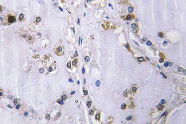 ETK / BMX Antibody (Tyr43)