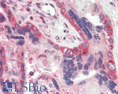 IHC-plus™ CALM1 / Calmodulin Antibody