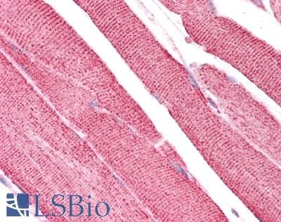 IHC-plus™ Polyclonal Rabbit anti-Human UCP2 Antibody (IHC)