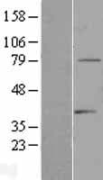 TDRD3 Protein (Over-Expression Lysate Myc-DDK (Flag))