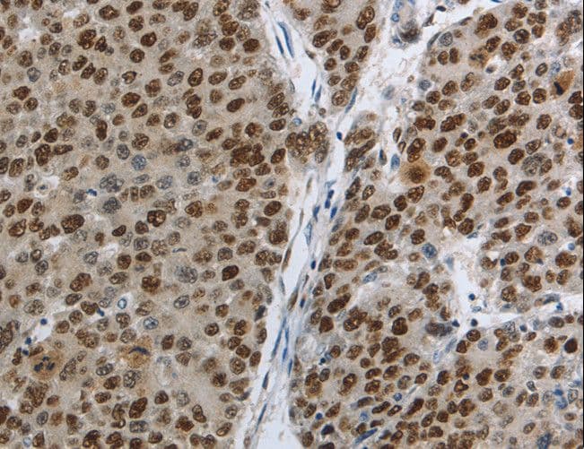 MCM3 Antibody
