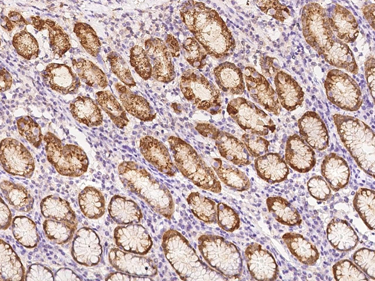 PGC / Pepsin C Antibody (Preservative Free)