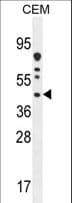 Polyclonal Rabbit anti-Human DNAJC22 / FLJ13236 Antibody (aa247-276, IHC, WB)