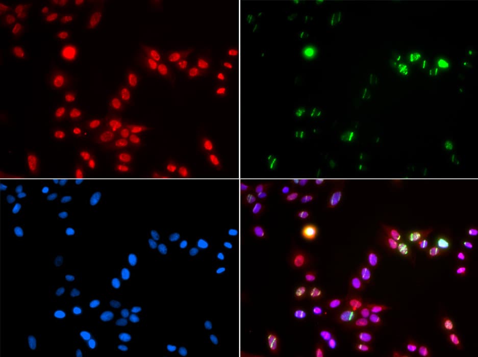 RNF2 / RING2 / RING1B Antibody