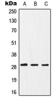 Polyclonal Rabbit anti-Human CD40L Antibody (Internal, WB)