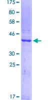 Human REG1A Protein (Recombinant GST)