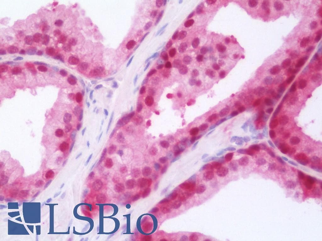 IHC-plus™ Polyclonal Rabbit anti-Human RARG / RAR-Gamma Antibody (IHC, WB)