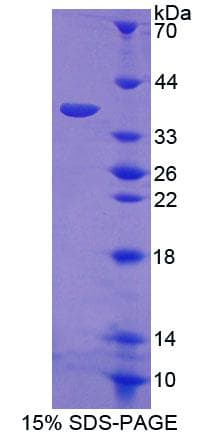 Human SPFH2 / ERLIN2 Protein (Recombinant His-T7)