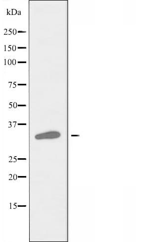 Polyclonal Rabbit anti-Human ACER3 Antibody (IHC, IF, WB)