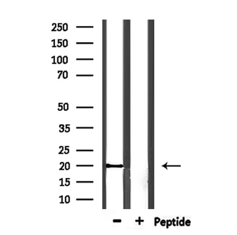 SNCG / Gamma-Synuclein Antibody