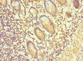 TAC1 Antibody (aa1-129)