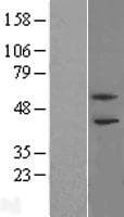 PHF21B Protein (Over-Expression Lysate Myc-DDK (Flag))