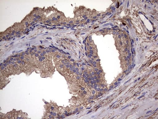 IL1RN Antibody (clone OTI2B1)