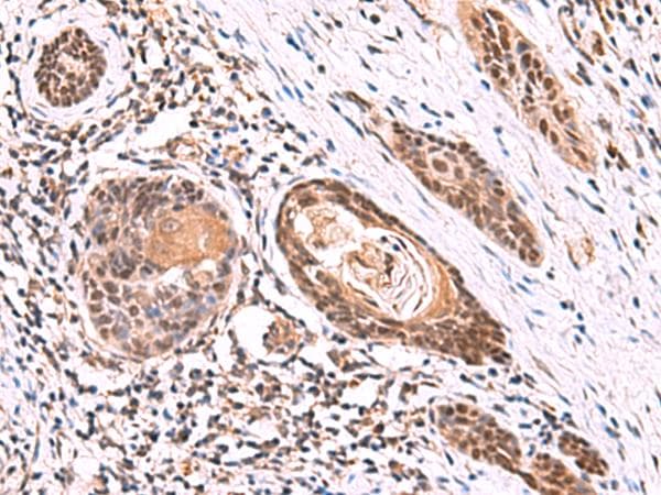 ITPR2 / IP3 Receptor Type 2 Antibody