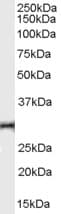 PathPlus™ TNFRSF14 / CD270 / HVEM Antibody (200-280 aa, Internal)