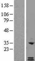 Human CXCL6 Protein (Over-Expression Lysate Myc-DDK (Flag))