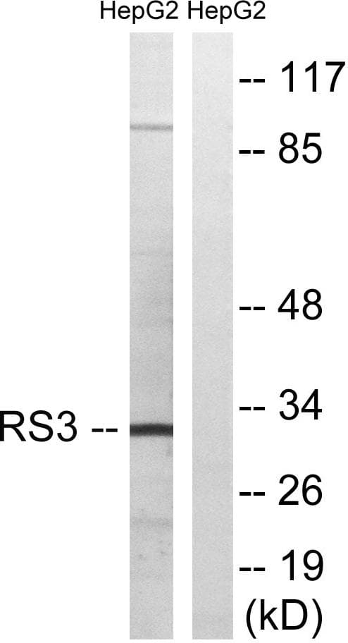 RPS3 / Ribosomal Protein S3 Antibody