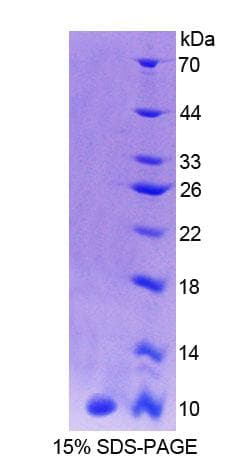 Human CALY Protein (Recombinant His-T7, N-terminus)