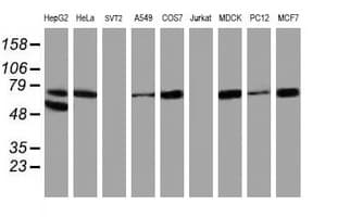 Monoclonal Mouse anti-Human ALOX15 / 15-Lipoxygenase Antibody (clone OTI3G8, IHC, IF, WB)