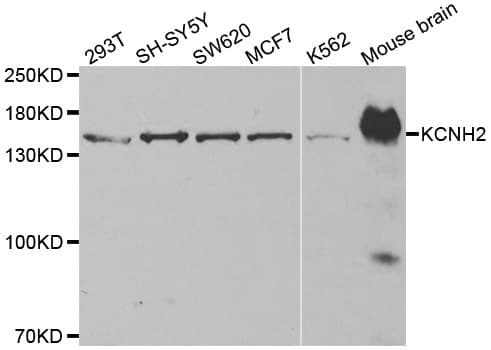 KCNH2 / HERG Antibody (aa886-899)