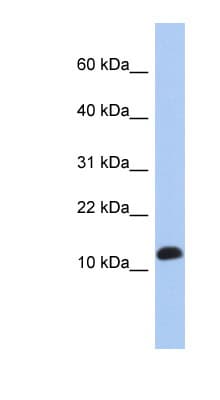 RPL30 / Ribosomal Protein L30 Antibody (C-Terminus)