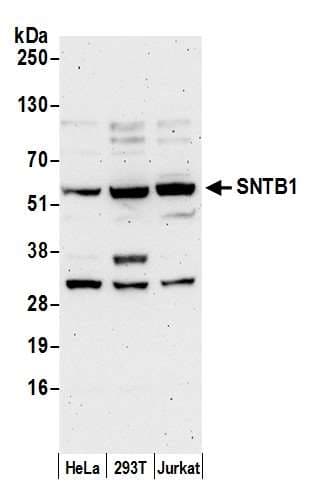 Polyclonal Rabbit anti-Human SNTB1 / A1B Antibody (aa75-125, WB)