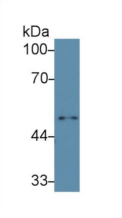 IL6R / IL6 Receptor Antibody (aa205-347)