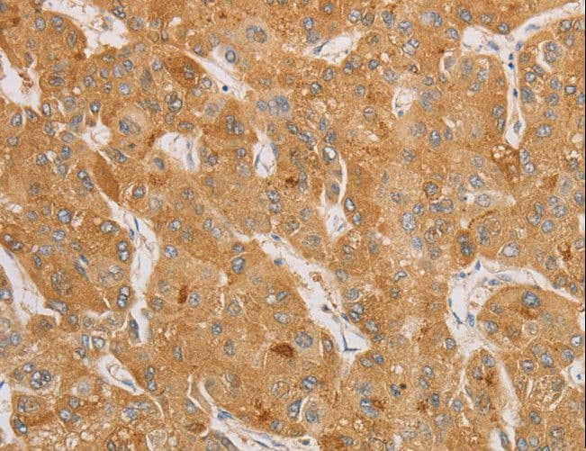 NGF Antibody