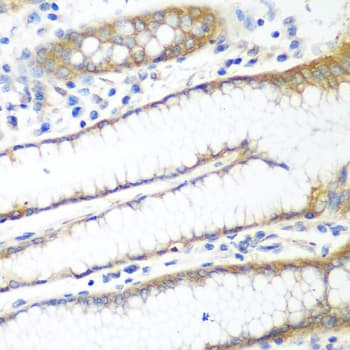 Polyclonal Rabbit anti-Human PPP4R1 / PP4R1 Antibody (IHC, WB)