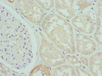 CPN1 Antibody