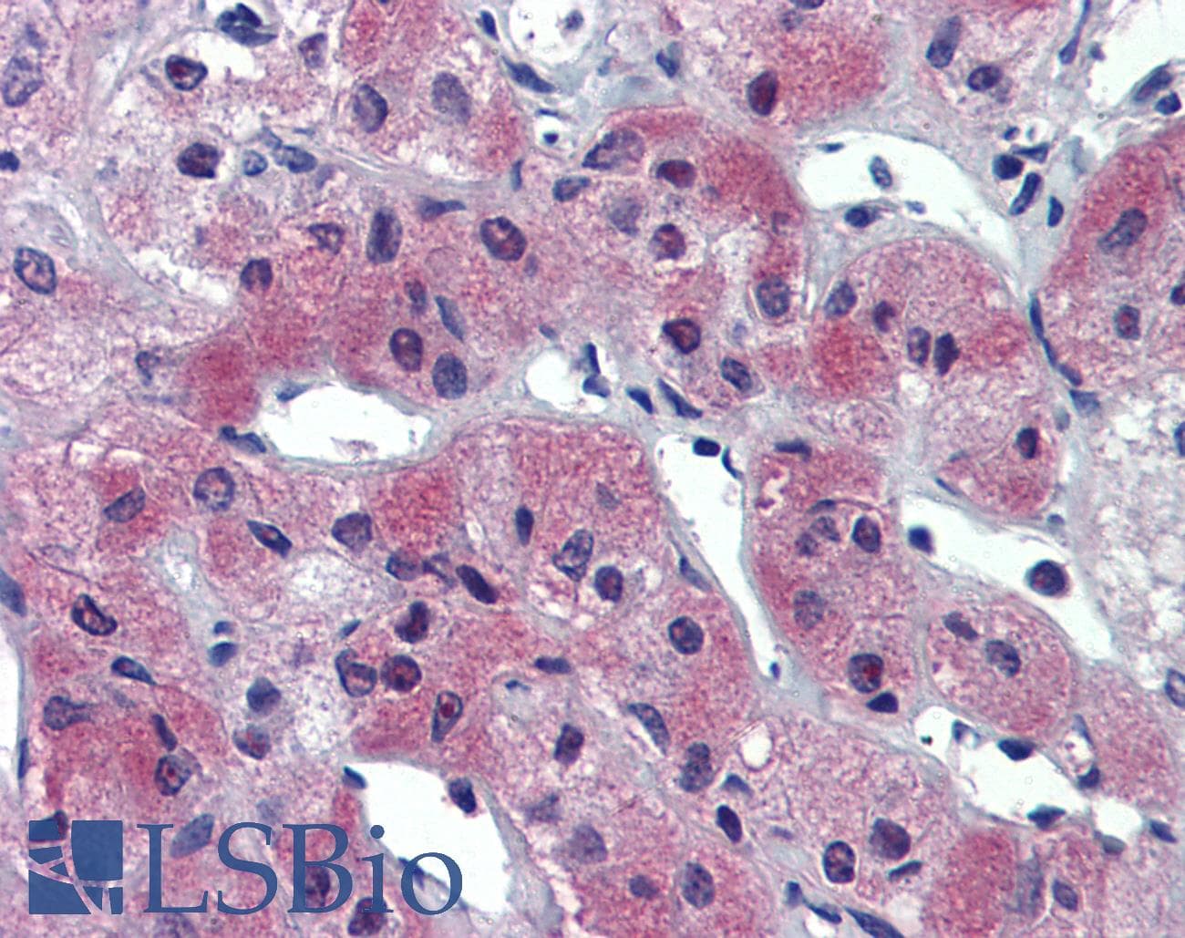 IHC-plus™ Polyclonal Rabbit anti-Human AIPL1 Antibody (IHC, IF, WB)