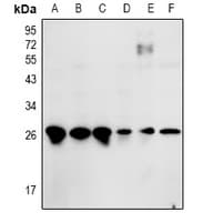 Polyclonal Rabbit anti-Human ZNF575 Antibody (WB)