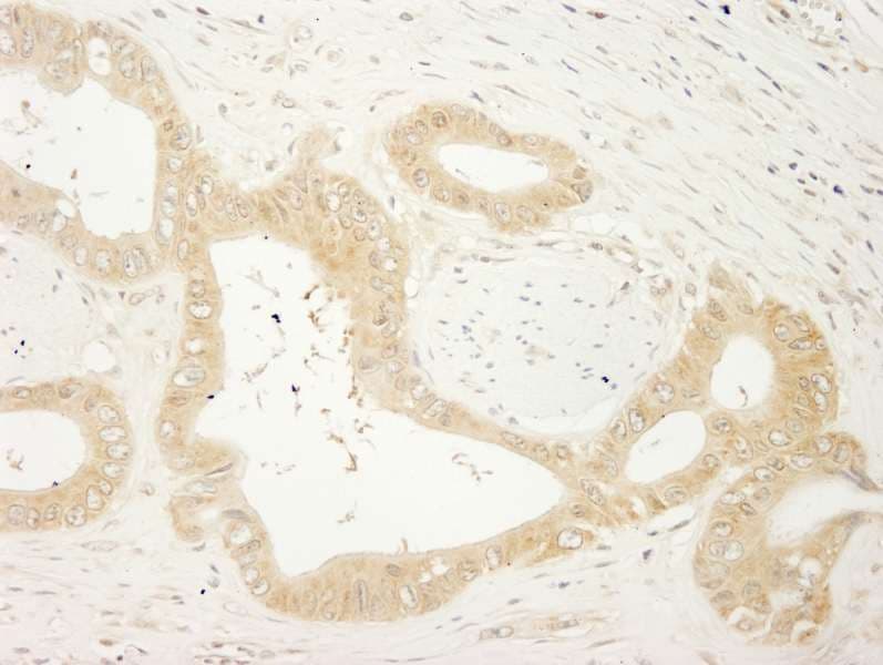 LARP1 / La-Related Protein 1 Antibody (aa275-325)