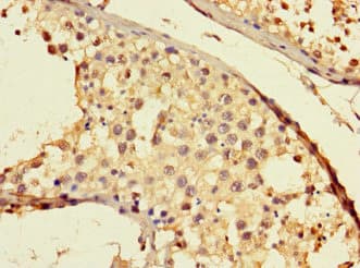 Polyclonal Rabbit anti-Human THADA Antibody (IHC, IF)