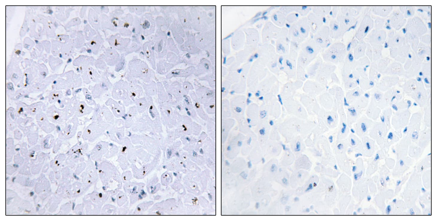 TP53BP1 / 53BP1 Antibody (phospho-Ser6)